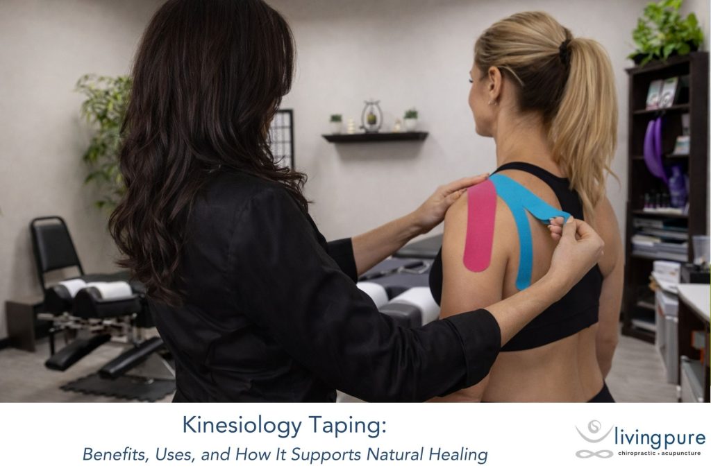 Kinesiology Taping: Benefits, Uses, and How It Supports Natural Healing