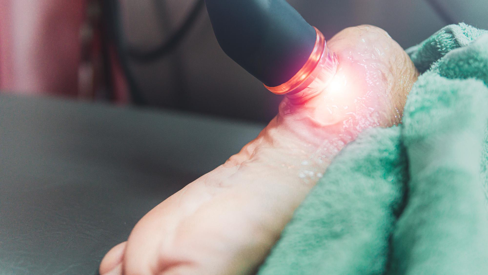Shockwave Therapy in Surprise, AZ
